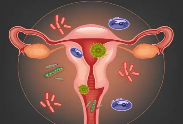 vaginal infections